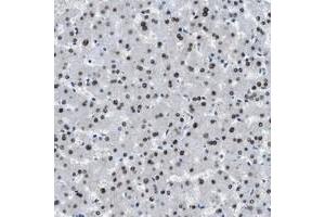 Immunohistochemical staining of human liver with OGFR polyclonal antibody  shows nuclear positivity in hepatocytes at 1:50-1:200 dilution. (OGFR 抗体)