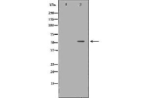 Western blot analysis of Hela whole cell lysates, using IRF5  Antibody. (IRF5 抗体  (C-Term))