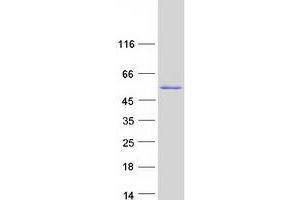 TBRG1 Protein (Transcript Variant 1) (Myc-DYKDDDDK Tag)