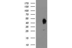 Western Blotting (WB) image for anti-Activating Signal Cointegrator 1 Complex Subunit 1 (ASCC1) antibody (ABIN1496742) (ASCC1 抗体)