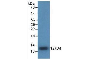 Detection of Recombinant IL8, Human using Polyclonal Antibody to Interleukin 8 (IL8) (IL-8 抗体  (AA 28-99))