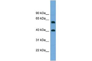 Western Blotting (WB) image for anti-Telomeric Repeat Binding Factor 2, Interacting Protein (TERF2IP) (Middle Region) antibody (ABIN2787164)