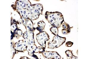 IHC-P: EIF2A antibody testing of human placenta tissue (EIF2S1 抗体  (Middle Region))