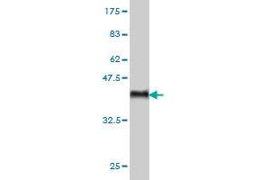 Western Blot detection against Immunogen (36. (ARAF 抗体  (AA 151-250))