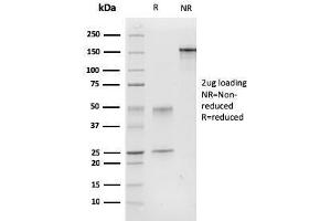 SDS-PAGE Analysis Purified Calponin-1 Mouse Monoclonal Antibody (CNN1/832). (CNN1 抗体)