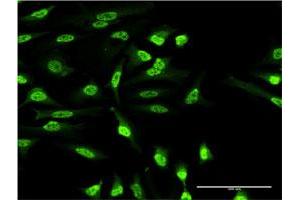Immunofluorescence of monoclonal antibody to OXSR1 on HeLa cell. (OXSR1 抗体  (AA 351-450))