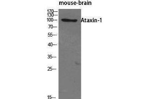 Western Blotting (WB) image for anti-Ataxin 1 (ATXN1) (Tyr1021) antibody (ABIN3173923) (Ataxin 1 抗体  (Tyr1021))