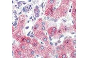 IHC analysis of FFPE human liver tissue stained with SYVN1 antibody