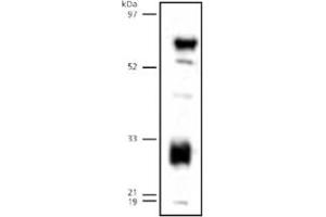Western blot analysis of LIPG on human endothelial lipase detected in transfected 293 lysates using LIPG polyclonal antibody . (LIPG 抗体  (C-Term))