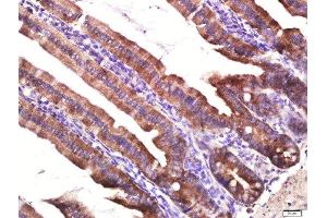 Paraformaldehyde-fixed, paraffin embedded Mouse small intestine tissue, Antigen retrieval by boiling in sodium citrate buffer(pH6) for 15min, Block endogenous peroxidase by 3% hydrogen peroxide for 20 minutes, Blocking buffer (normal goat serum) at 37°C for 30min, Antibody incubation with Layilin Polyclonal Antibody, Unconjugated  at 1:400 overnight at 4°C, followed by a conjugated secondary and DAB staining (Layilin 抗体  (AA 281-382))