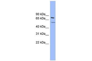 WB Suggested Anti-KCNQ4 Antibody Titration:  0. (KCNQ4 抗体  (Middle Region))