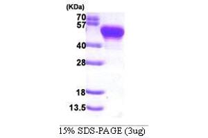 Figure annotation denotes ug of protein loaded and % gel used. (Protein A (AA 37-469) Peptide)