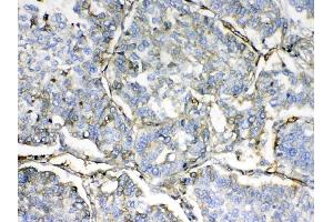 Immunohistochemistry (IHC) image for anti-Hemoglobin, delta (HBd) (AA 2-147) antibody (ABIN5518999)