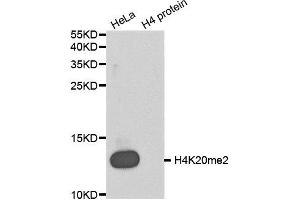 Western blot analysis of extracts of various cell lines, using DiMethyl-Histone H4-K20 antibody. (Histone H4 抗体  (2meLys20))