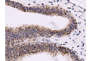 Immunohistochemical staining of paraffin-embedded Human liver tissue using anti-CBWD1 mouse monoclonal antibody. (CBWD1 抗体)