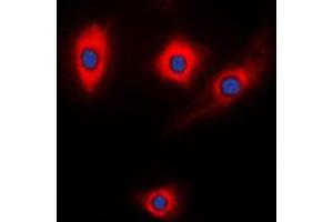 Immunofluorescent analysis of Kalirin staining in NIH3T3 cells. (KALRN 抗体  (Center))