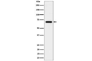 Western blot analysis of CD125 in Human serum cell lysate.