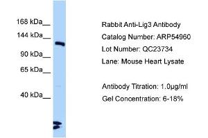 Western Blotting (WB) image for anti-Ligase III, DNA, ATP-Dependent (LIG3) (C-Term) antibody (ABIN971036) (LIG3 抗体  (C-Term))