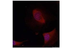 Image no. 3 for anti-Activating Transcription Factor 2 (ATF2) (Ser44), (Ser62) antibody (ABIN197144)