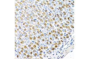 Immunohistochemistry of paraffin-embedded mouse stomach using FECH antibody (ABIN5974679) at dilution of 1/100 (40x lens). (FECH 抗体)