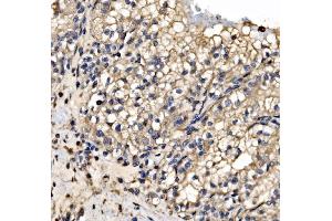IHC analysis of SRP72 using anti-SRP72 antibody (ABIN7601648). (SRP72 抗体  (AA 40-460))
