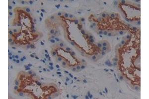 Immunohistochemistry (IHC) image for anti-Alanine Aminotransferase (ALT) (AA 581-738) antibody (ABIN7433093)