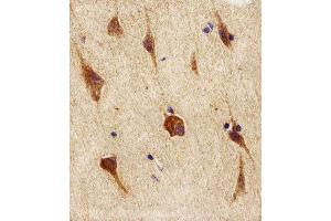 Immunohistochemical analysis of paraffin-embedded H. (NEK2 抗体  (AA 396-426))