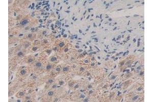 Detection of MAPKAPK2 in Human Liver Tissue using Polyclonal Antibody to MAP Kinase Activated Protein Kinase 2 (MAPKAPK2) (MAPKAP Kinase 2 抗体  (AA 139-367))
