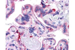 Immunohistochemistry (IHC) image for anti-KIT Ligand (KITLG) (Middle Region) antibody (ABIN2781827) (KIT Ligand 抗体  (Middle Region))