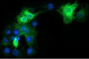 Immunofluorescent staining of COS7 cells transiently transfected by pCMV6-ENTRY FCGR1A with FCGR1A monoclonal antibody, clone 3D3 . (FCGR1A 抗体)