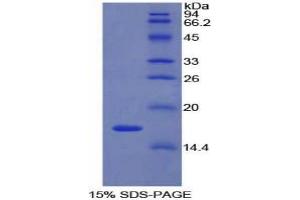 SDS-PAGE analysis of Rat LYAR Protein. (LYAR 蛋白)