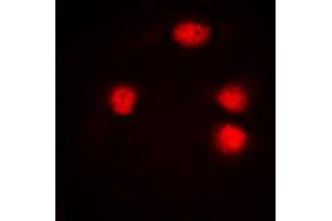 Immunofluorescent analysis of ZIC1/2/3 staining in Jurkat cells. (ZIC1/2/3 抗体  (Center))