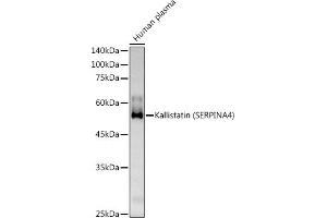 Western blot analysis of extracts of Human plasma, using Kallistatin (SERPIN) Rabbit pAb antibody (ABIN6131346, ABIN6147573, ABIN6147574 and ABIN6223161) at 1:500 dilution. (SERPINA4 抗体  (AA 178-427))