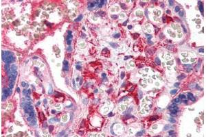 Human Placenta (formalin-fixed, paraffin-embedded) stained with PF4 antibody ABIN351496 at 5 ug/ml followed by biotinylated secondary antibody, alkaline phosphatase-streptavidin and chromogen. (PF4 抗体)