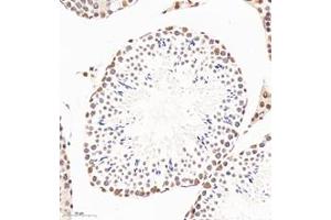 Immunohistochemistry analysis of paraffin-embedded mouse testis using,PQBP1 (ABIN7075126) at dilution of 1: 6000