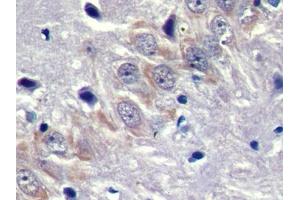 DAB staining on IHC-P; Samples: Rat Cerebrum Tissue (DMPK 抗体  (AA 1-152))