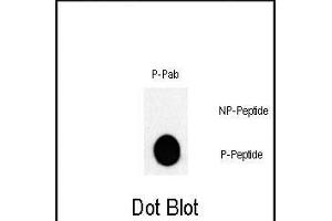 Dot blot analysis of Phospho-JUN- Pab (Cat. (C-JUN 抗体  (pThr243))