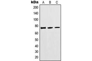 Western blot analysis of MTHFR expression in HEK293 (A), Jurkat (B), A549 (C) whole cell lysates. (MTHFR 抗体  (Center))