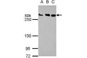 WB Image Sample (30 ug of whole cell lysate) A: Jurkat B: Raji C: K562 5% SDS PAGE antibody diluted at 1:1000 (CHD4 抗体  (N-Term))