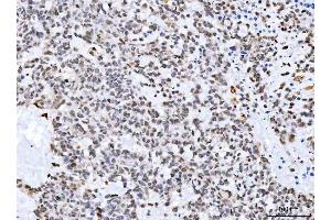 IHC analysis of Aurora A/AURKA using anti-Aurora A/AURKA antibody (ABIN7600751).