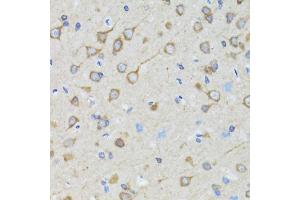 Immunohistochemistry of paraffin-embedded rat brain using TOLLIP antibody. (TOLLIP 抗体)