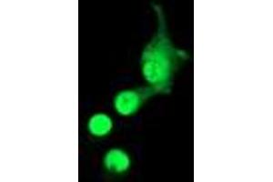 Anti-ACD mouse monoclonal antibody (ABIN2455492) immunofluorescent staining of COS7 cells transiently transfected by pCMV6-ENTRY ACD (RC204381). (ACD 抗体)