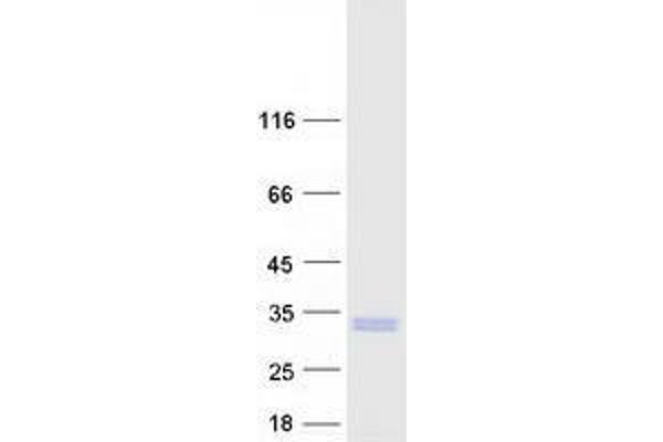 TMEM98 Protein (Transcript Variant 1) (Myc-DYKDDDDK Tag)