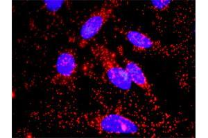 Proximity Ligation Analysis of protein-protein interactions between FAS and CTNNB1. (FAS 抗体  (AA 1-335))