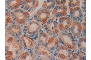 Immunohistochemistry (IHC) image for anti-Cyclin D2 (CCND2) (AA 47-267) antibody (ABIN7439681)