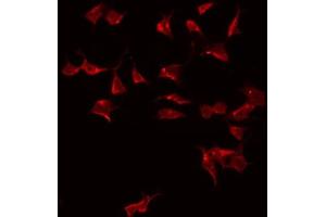 ABIN6275031 staining HeLa by IF/ICC. (C1QL2 抗体  (C-Term))