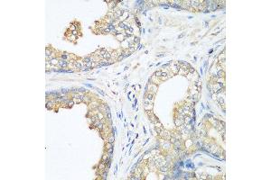 Immunohistochemistry of paraffin-embedded human prostate using CBL antibody at dilution of 1:200 (40x lens). (CBL 抗体)