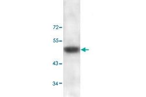 Western blot analysis of human skin lysate with ADAMTS2 polyclonal antibody  at 1 : 100 dilution. (Adamts2 抗体  (C-Term))