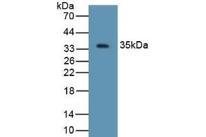 Detection of Recombinant DEFb2, Rat using Polyclonal Antibody to Defensin Beta 2 (DEFb2) (beta 2 Defensin 抗体  (AA 23-63))