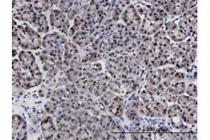 Image no. 1 for anti-LIM Domains Containing 1 (LIMD1) (AA 577-675) antibody (ABIN599481) (LIMD1 抗体  (AA 577-675))